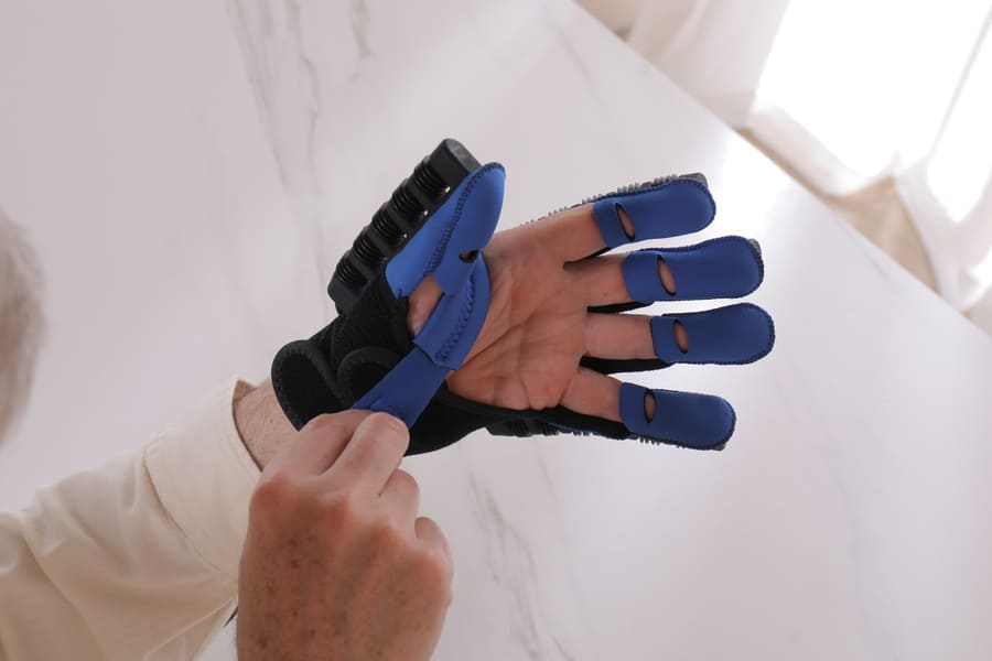Patient fitting the Syrebo C12 power glove, each finger in its own sleeve